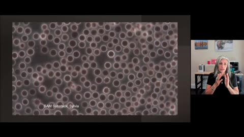 Synthetic Red Blood Cells being broken down by Methylene blue