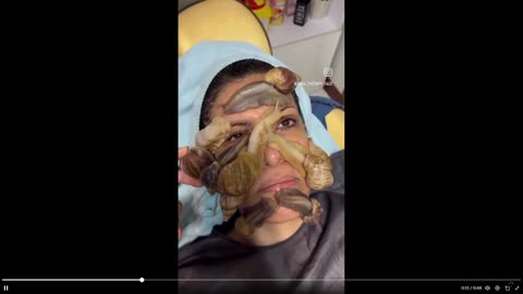 WHAT? Would you do this? Snail skin therapy for hydration, repair and anti aging
