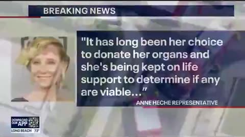 Shocking: Anne Heche trying to crawl out of her body bag? Not Burned? Still Alive but in a body bag?