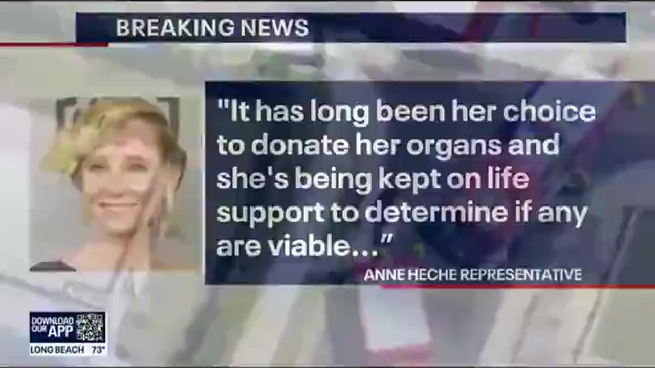 Shocking: Anne Heche trying to crawl out of her body bag? Not Burned? Still Alive but in a body bag?