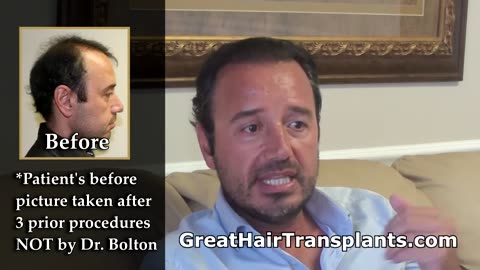 Hair Transplant for Thin Hair – Amazing Results by Dr. Brett Bolton