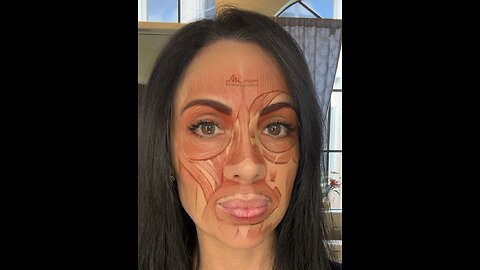 DIY Botox Dangers to Avoid