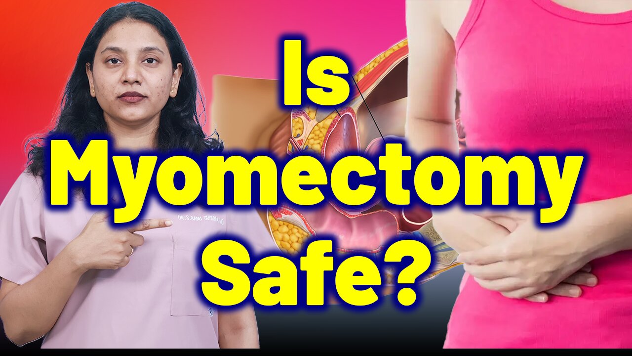 Worried About Fibroid Surgery ? Myomectomy Is Safer Than You Think. | Treatment & Cure | Homeopathy