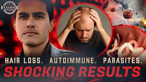 Hair Loss, Autoimmune, Parasites? Red Light Therapy May Be Your Miracle - Jonathan Otto