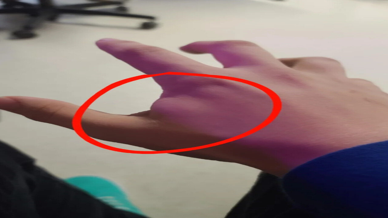 Behold, A Noisome and Grievous Sore !