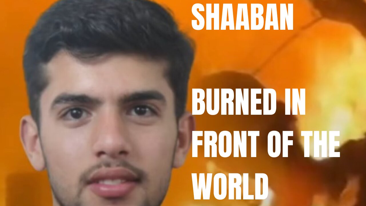 Shaaban Burned in front of the world