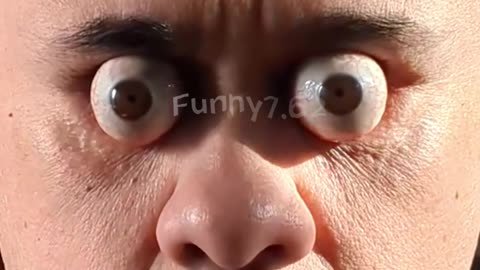 Farthest eyeball pop (Male) 👀 19 mm (0.74 inch) by Williams Martin Sanchez Lopez in GWR