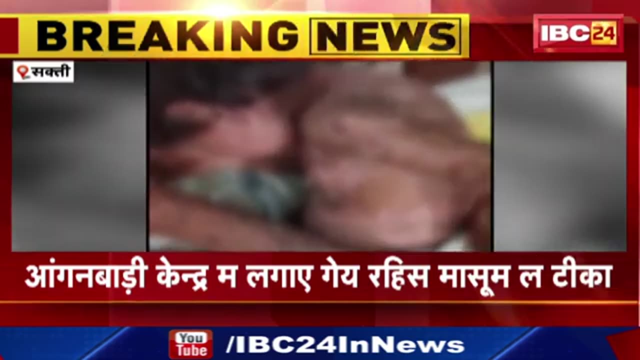 Chhattisgarh: 5 year old child developed boils all over body following vaccination