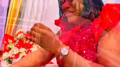 Love Beyond Scars | Behind the Scenes 🎬💖