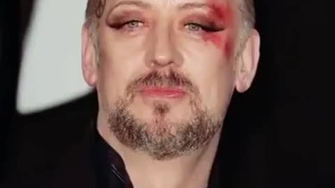 Black eye club