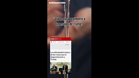 ¿Qué le pasa realmente a las manos de Trump?