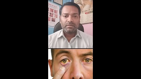 Normal hemoglobin level ।