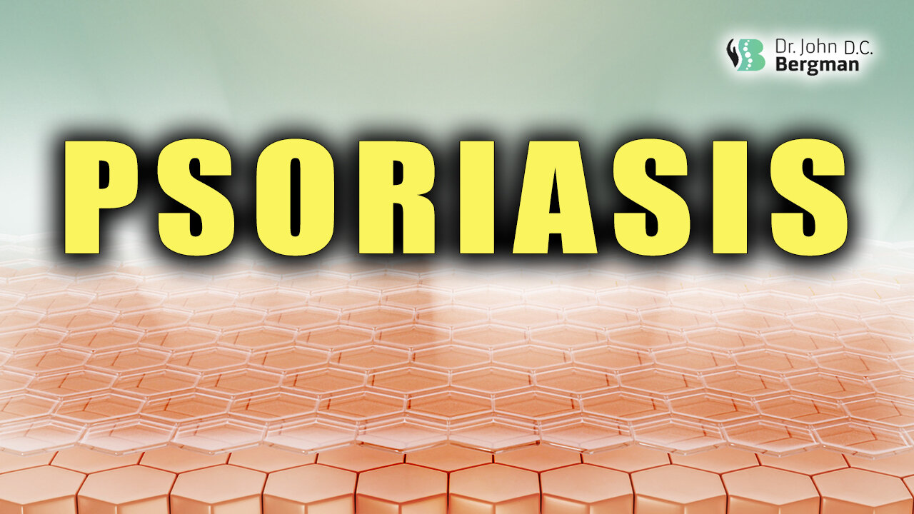 Psoriasis 🦵💪🙂↕️🌱