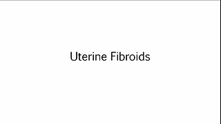 Uterine Fibroids