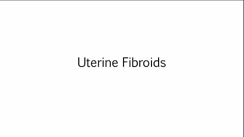 Uterine Fibroids
