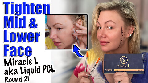 Tighten Mid and Lower Face with Miracle L, Liquid PCL! AceCosm.com code Jessica10 Saves you Money