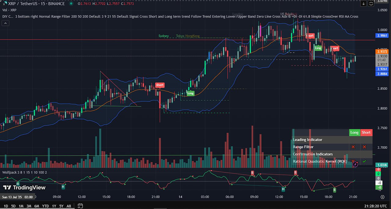 🔴 LIVE XRP Chart Stream Party | AI Trading Signals 🔴