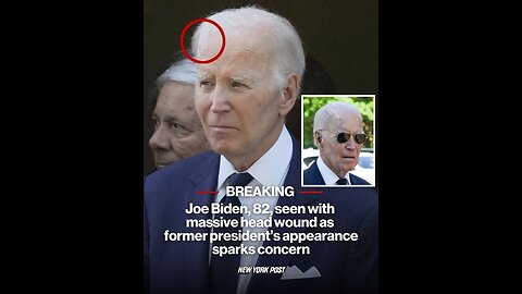 Joe Biden, 82, seen with massive head wound as former president’s appearance sparks concern