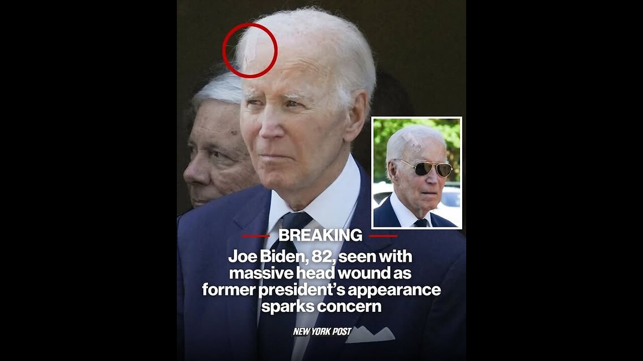 Joe Biden, 82, seen with massive head wound as former president’s appearance sparks concern
