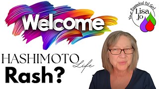 Hashimoto’s Symptoms No One Talks About: Rashes & Hives-suggestions-Lisa Jo your essential oil girl