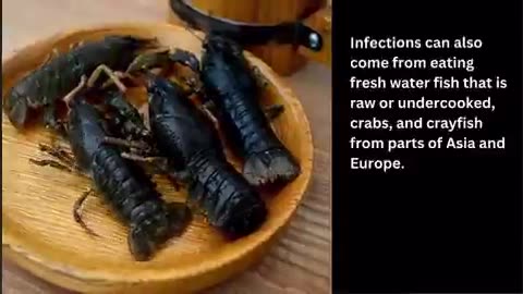 People in the U.S. get infected with liver flukes P2