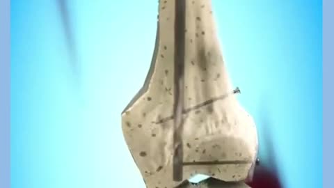 _medicina _fratura _saude _biologia _ciencia _vocesabia _curiosidades(