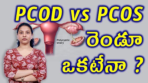 PCOS Vs PCOD రెండూ ఒకటేనా? How To Differenciate PCOD and PCOS Full Guide Homeopathy Treatment Cure