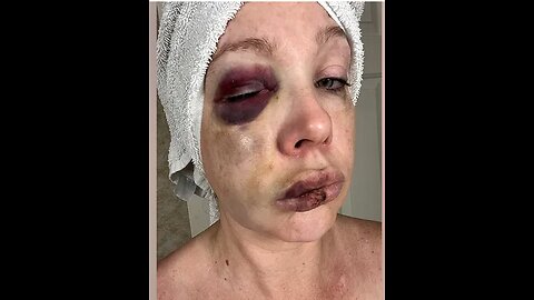 Cincinnati Officials blame the White ppl for being attacked by Blacks