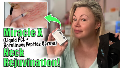 Miracle X Neck Rejuvination! AceCosm.com code Jessica10 saves you money