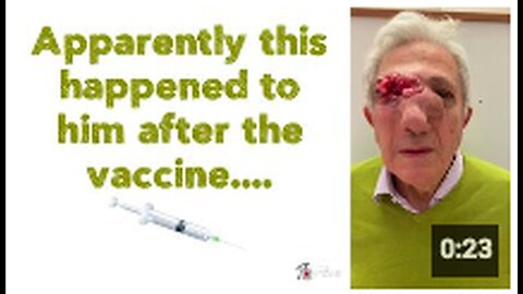 "Unexpected Events Following His Vaccination: A Narrative 🤷‍♂️💉"
