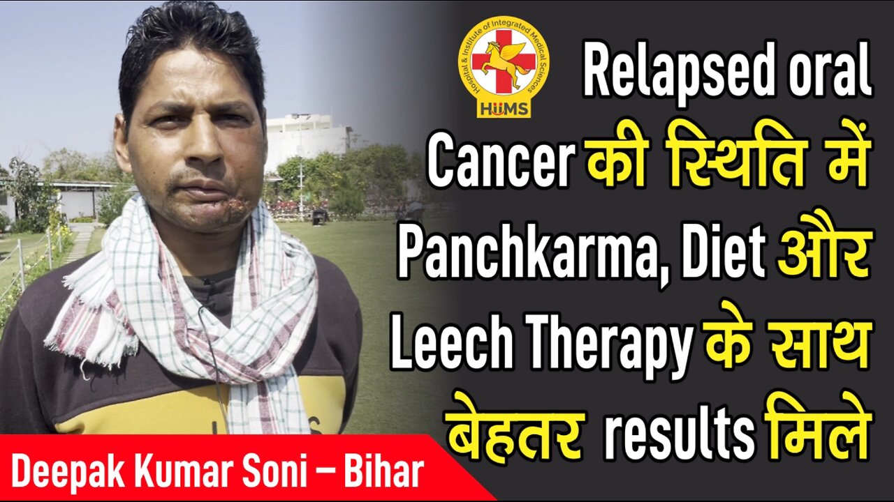 Relapsed oral Cancer की स्थिति में Panchkarma, Diet और Leech Therapy के साथ बेहतर results मिले