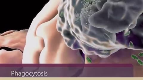 Inflammation
