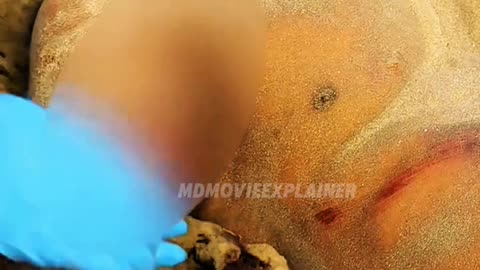 This Men Stuck By Lightning⚡|| आदमी जमीन के अंदर फंस गया