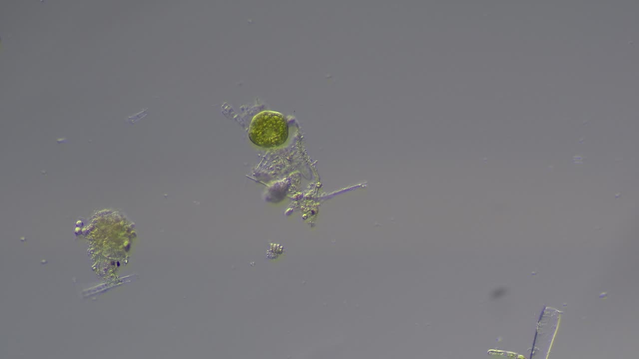 Paramecium +small Unicellular Dileptus