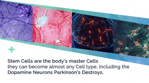 Can Stem Cells BE the KEY to Curing Parkinson's Disease?