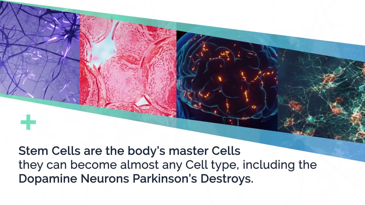 Can Stem Cells BE the KEY to Curing Parkinson's Disease?