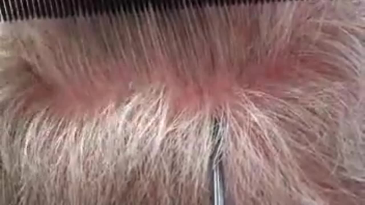 Dr. Brett Bolton Shows Another Amazing Undetectable Suture Line