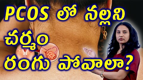 PCOS లో నల్లని చర్మం రంగు పోవాలంటే? PCOS Skin Darkening Explained | Acanthosis Nigricans Cure Clinic