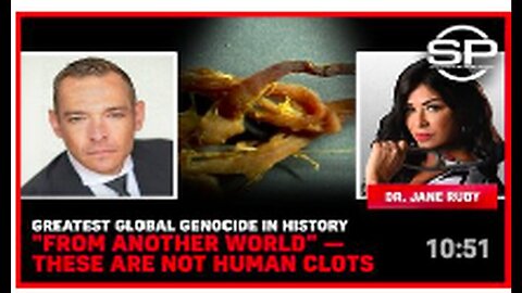 "Historical Global Genocide: Unearthly Origin and Non-Human Clots Explored"