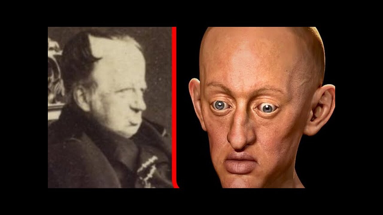 The Most Inbred Monarchs In History