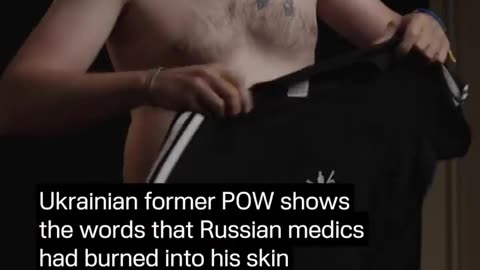 😱💉 Ukraine Russia War | Ukrainian POW Branded by Russian Surgeon | RCF