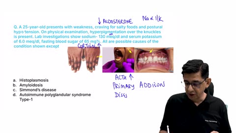 47. Endocrinology Image Based Questions