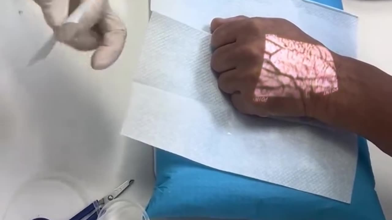Using a vein finder to ensure accurate and comfortable injections.