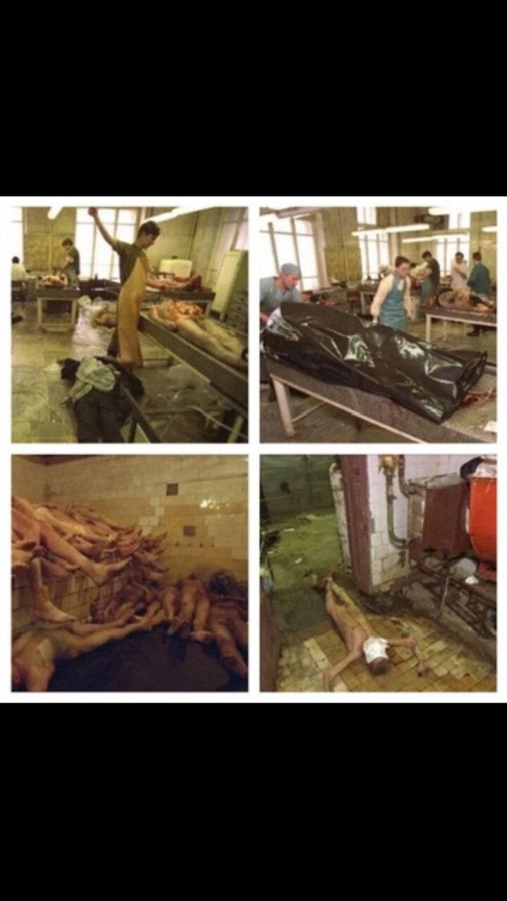 Organ Harvesting is real (WARNING: Disturbing Viewing)