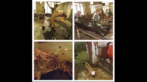 Organ Harvesting is real (WARNING: Disturbing Viewing)
