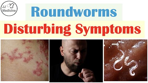 5 Horrifying Symptoms of Roundworm Infections