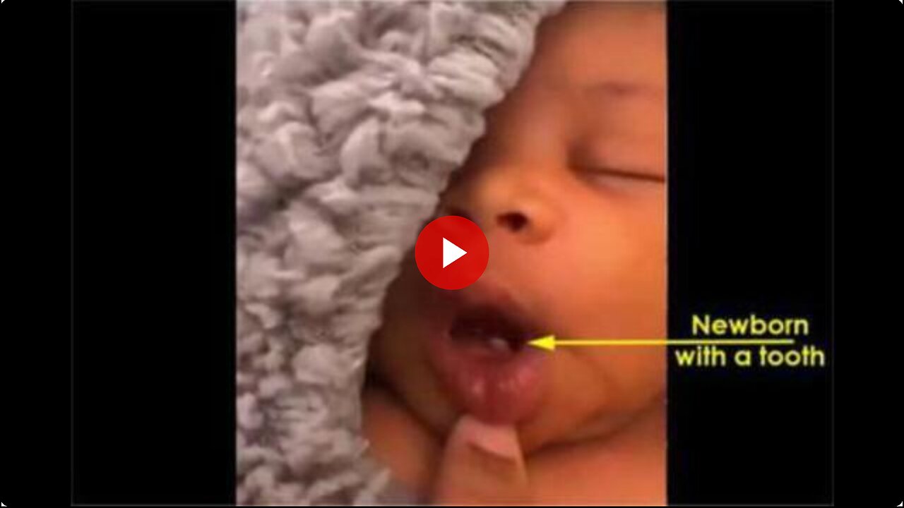 Black eyed babies from the Covid Vaccination era - They are very different.