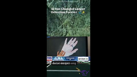 AI Just Changed Cancer Detection Forever 🩺✨