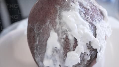 How long does a hair transplant take?