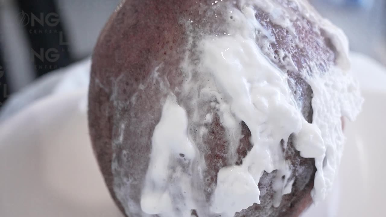 How long does a hair transplant take?